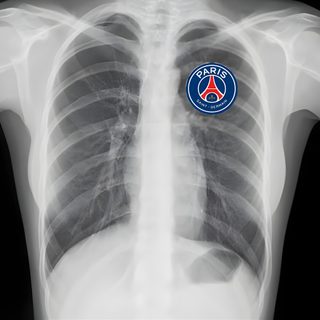 an x - ray image shows the chest and ribs, with a logo on it Football Halloween Psg Paris Saint Germain Tattoo, Kylian Mbappé, Paris Saint-germain, dark slate gray