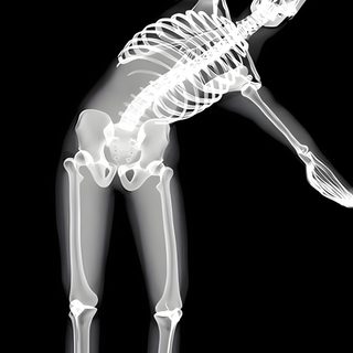 an x - ray image of a skeleton holding his arm in the air and pointing at something Matching Halloween For Besties Iphone Matching Bff, Bestie For Three, Matching Bff Aesthetic, black