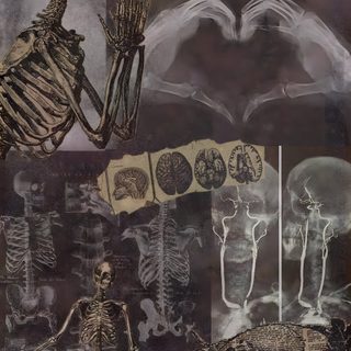 a collage of skeletons and human bones Halloween X-ray - Tan & Black Remedy, Medical Background Aesthetic, Bone, Background Skull, dark slate gray