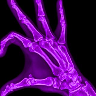 an x - ray image of a purple hand Halloween Skeleton Hand Purple Halloween Skeleton Hand Purple, Purple Hand, Purple Aesthetic Bones, black