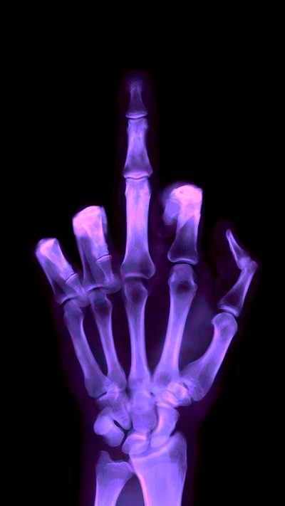 an x - ray image of a hand with the thumb pointing up in purple light Halloween Skeleton Hand Purple Purple Tentacle Aesthetic, Purple Eldritch Aesthetic, Creepy Purple Aesthetic, black