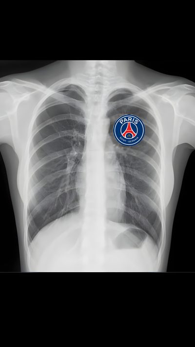 an x - ray image shows the chest and ribs, with a logo on it Football Halloween Psg Paris Saint Germain Tattoo, Kylian Mbappé, Paris Saint-germain, dark slate gray