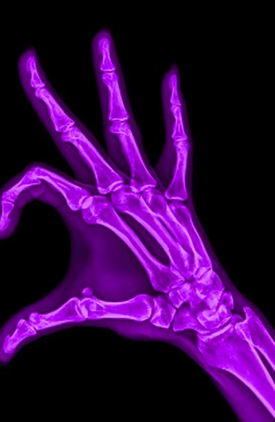 an x - ray image of a purple hand Halloween Skeleton Hand Purple Halloween Skeleton Hand Purple, Purple Hand, Purple Aesthetic Bones, black